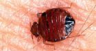 New Yorker inadvertently sets rental car on fire while trying to kill bedbugs